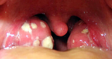 throat