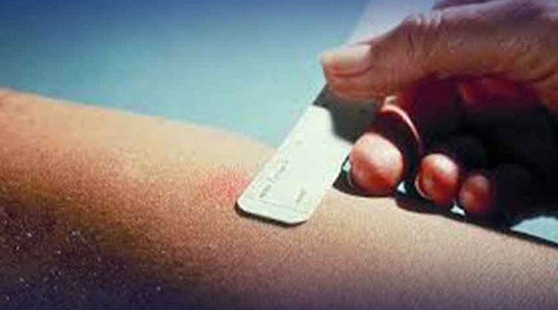 pakistan-tb-test-kit-shortage-diagnosis-affected